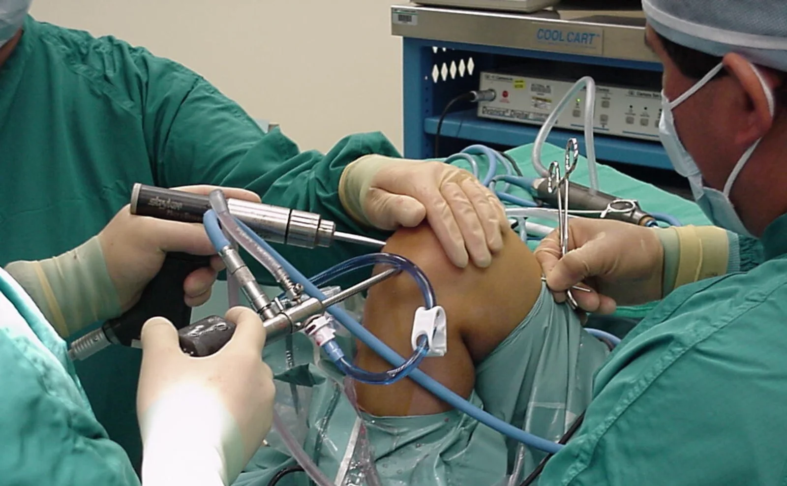 Advanced arthroscopic surgery at Hakimi Ortho Care
